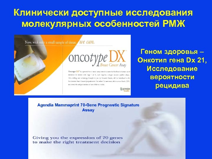 Клинически доступные исследования молекулярных особенностей РМЖ Геном здоровья – Онкотип гена Dx 21, Исследование
