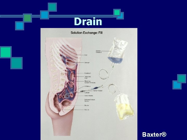 Drain Baxter® 