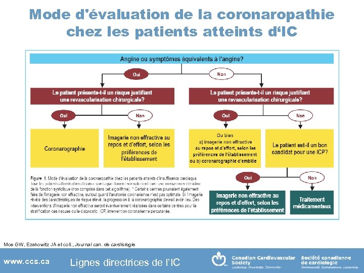 Mode d'évaluation de la coronaropathie chez les patients atteints d‘IC Moe GW, Ezekowitz JA