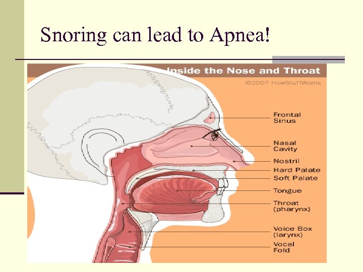 Snoring can lead to Apnea! 