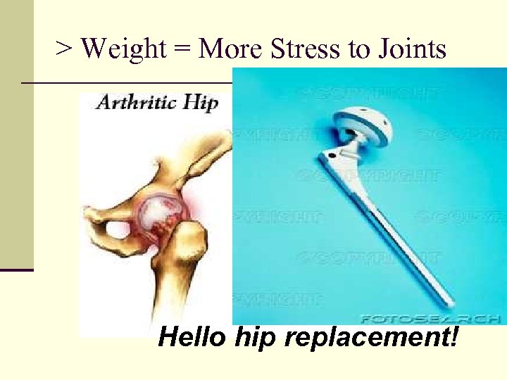 > Weight = More Stress to Joints Hello hip replacement! 