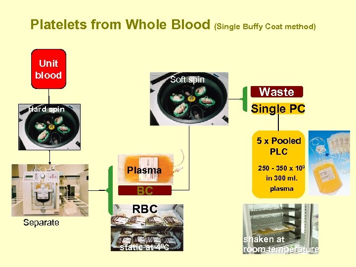 Platelets from Whole Blood (Single Buffy Coat method) Unit blood Soft spin Waste Single