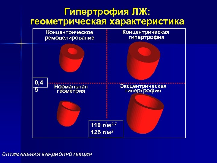 Гипертрофия. Эксцентрический концентрический ремоделирование желудочка. Концентрический Тип ремоделирования миокарда. Концентрическое ремоделирование левого желудка. Концентрическая и эксцентрическая гипертрофия.