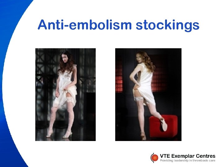 Anti-embolism stockings 