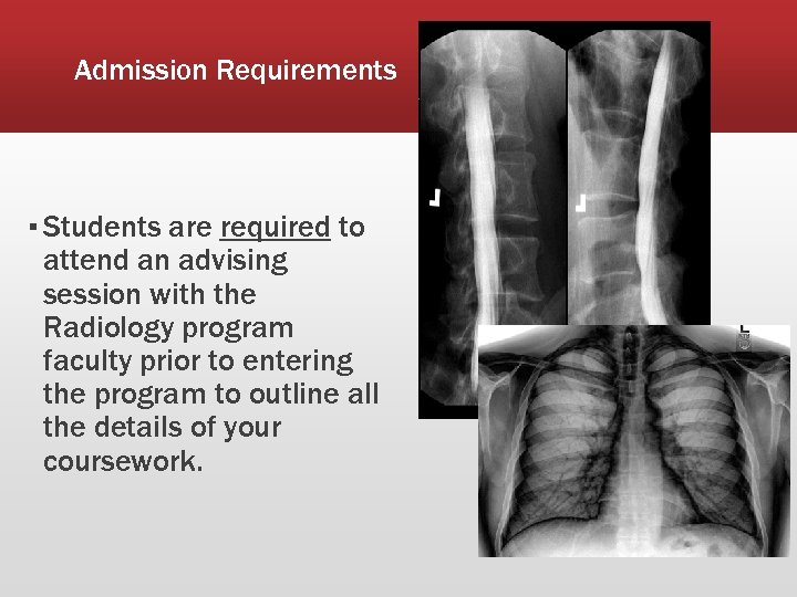 Admission Requirements ▪ Students are required to attend an advising session with the Radiology