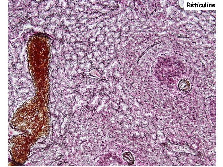 Réticuline 