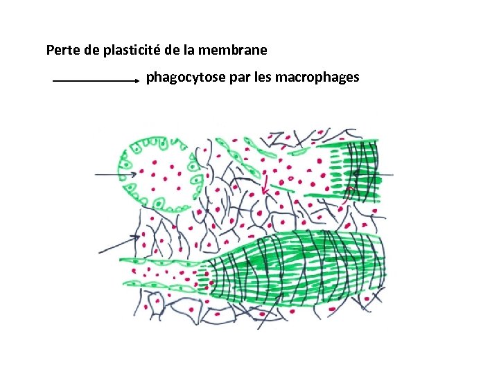 Perte de plasticité de la membrane phagocytose par les macrophages 