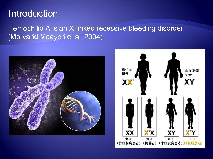 Introduction Hemophilia A is an X-linked recessive bleeding disorder (Morvarid Moayeri et al. 2004).