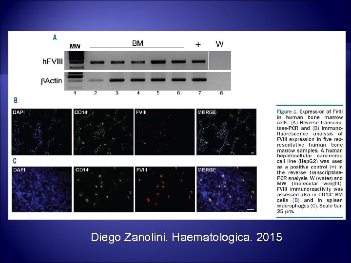 Diego Zanolini. Haematologica. 2015 