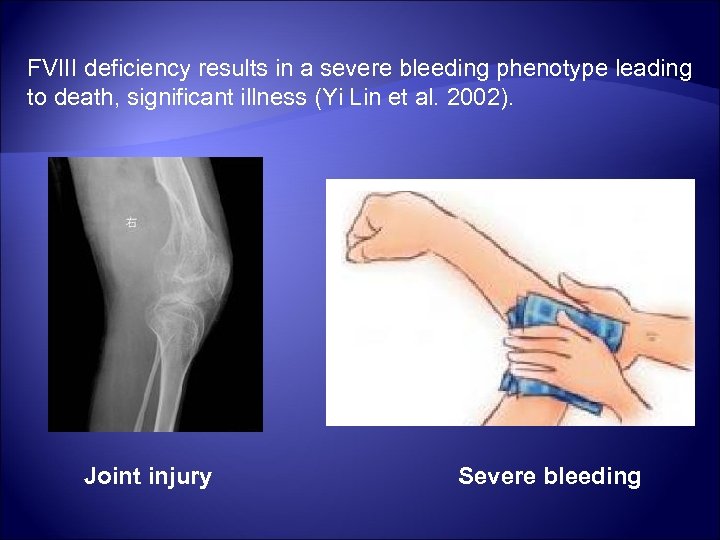 FVIII deficiency results in a severe bleeding phenotype leading to death, significant illness (Yi