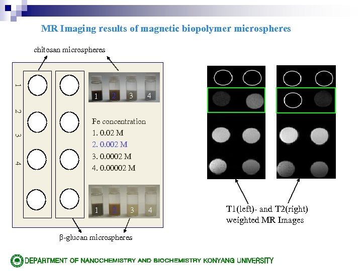 MR Imaging results of magnetic biopolymer microspheres chitosan microspheres 1 1 2 3 4