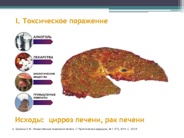 . I. Токсическое поражение. 35% 38, 2% 42% 83% 95% 55% Исходы: цирроз печени,