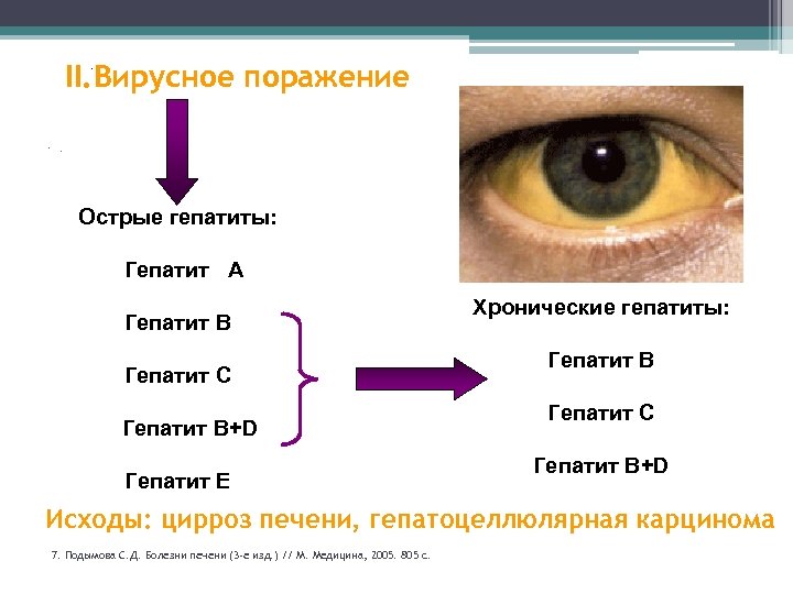 II. Вирусное поражение. . . Острые гепатиты: 35% Гепатит А 38, 2% 42% Гепатит