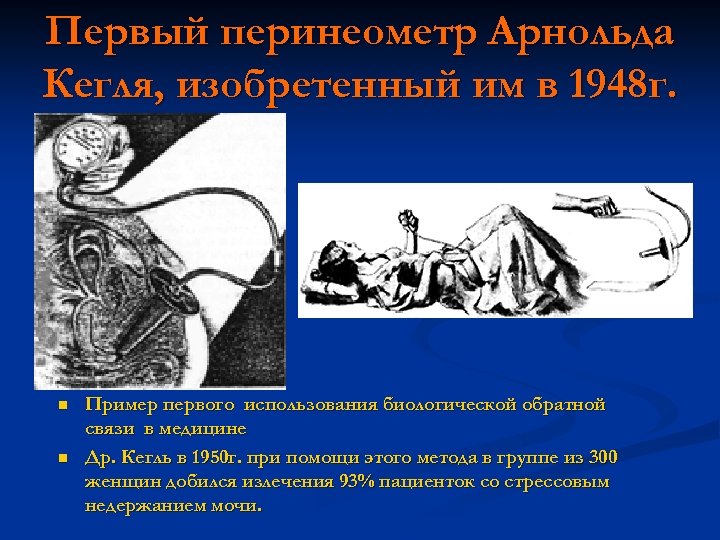 Первый перинеометр Арнольда Кегля, изобретенный им в 1948 г. n n Пример первого использования