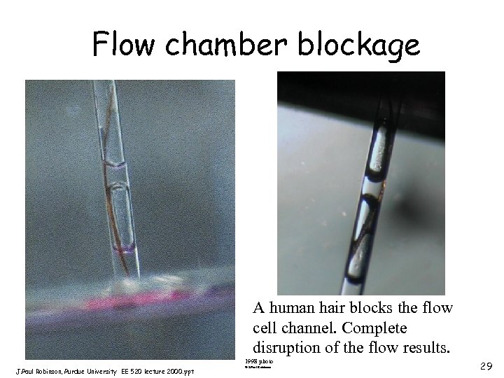 Flow chamber blockage A human hair blocks the flow cell channel. Complete disruption of