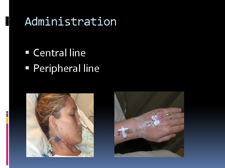 Administration Central line Peripheral line 