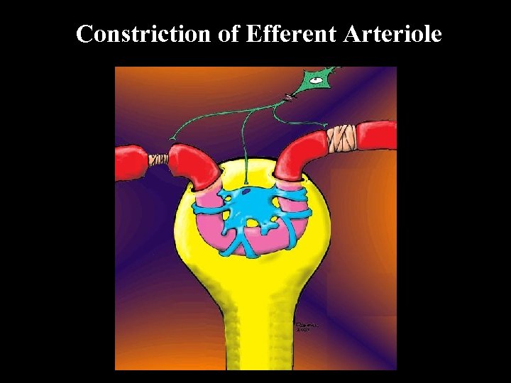 Constriction of Efferent Arteriole 