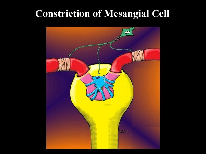 Constriction of Mesangial Cell 