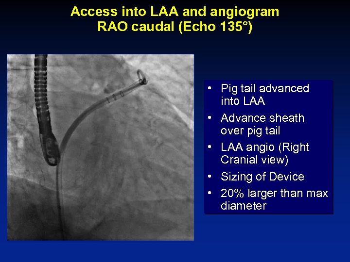 Access into LAA and angiogram RAO caudal (Echo 135°) • Pig tail advanced into