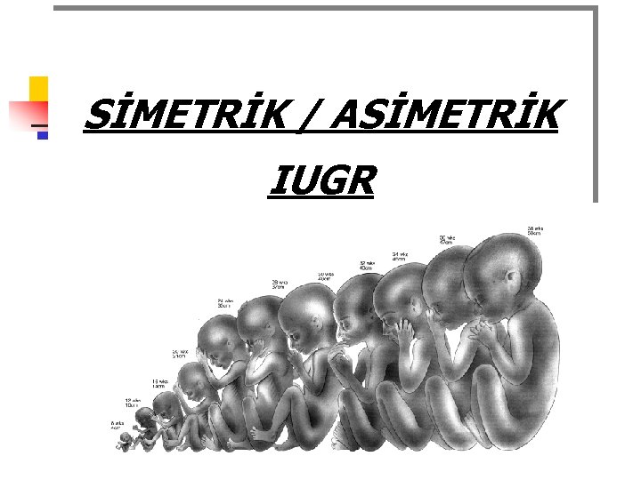 SİMETRİK / ASİMETRİK IUGR 