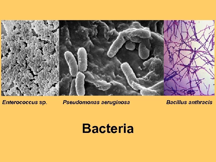 Enterococcus sp. Pseudomonas aeruginosa Bacteria Bacillus anthracis 
