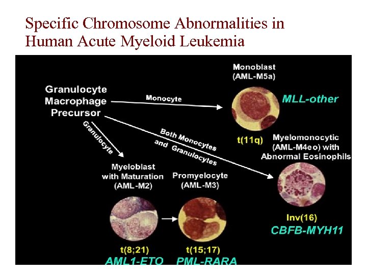 Specific Chromosome Abnormalities in Human Acute Myeloid Leukemia 