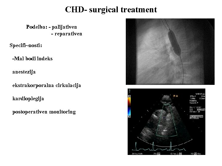 CHD- surgical treatment Podelba: - palijativen - reparativen Specifi~nosti: -Mal bodi indeks anestezija ekstrakorporalna