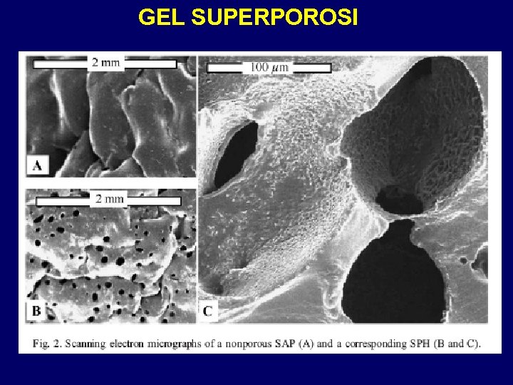 GEL SUPERPOROSI 