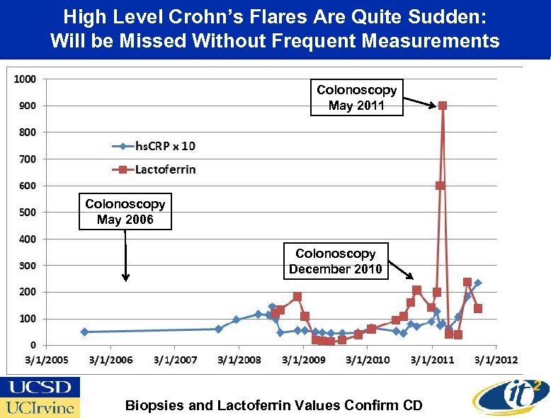 High Level Crohn’s Flares Are Quite Sudden: Will be Missed Without Frequent Measurements Colonoscopy