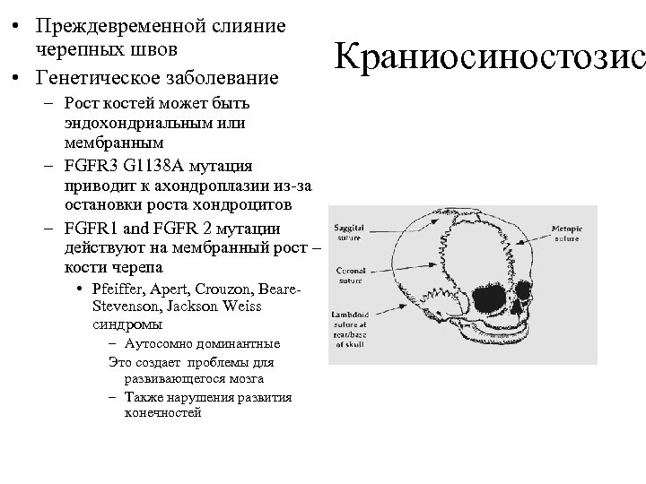  • Преждевременной слияние черепных швов • Генетическое заболевание – Рост костей может быть