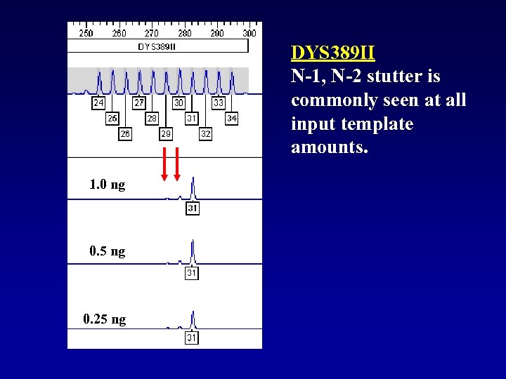 DYS 389 II N-1, N-2 stutter is commonly seen at all input template amounts.