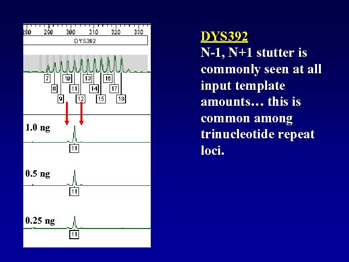 1. 0 ng 0. 5 ng 0. 25 ng DYS 392 N-1, N+1 stutter