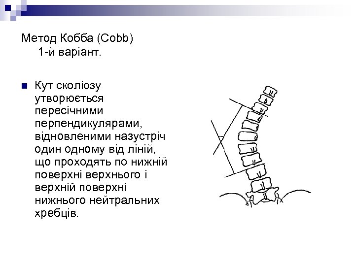 Метод Кобба (Cobb) 1 -й варіант. n Кут сколіозу утворюється пересічними перпендикулярами, відновленими назустріч