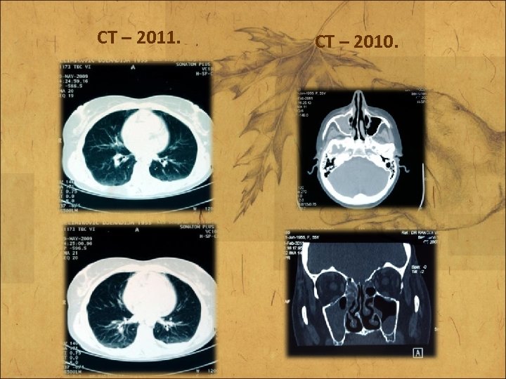 CT – 2011. CT – 2010. 