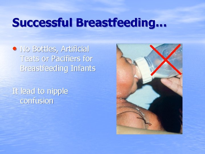 Successful Breastfeeding… • No Bottles, Artificial Teats or Pacifiers for Breastfeeding Infants It lead