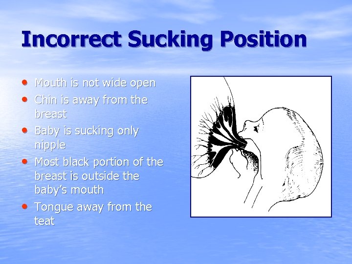 Incorrect Sucking Position • Mouth is not wide open • Chin is away from