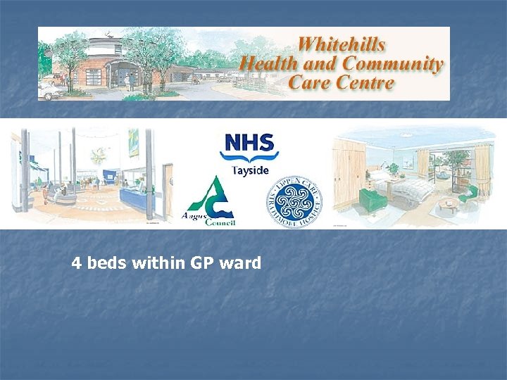 4 beds within GP ward 
