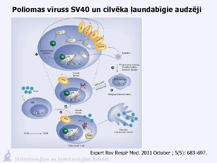 Poliomas vīruss SV 40 un cilvēka ļaundabīgie audzēji Expert Rev Respir Med. 2011 October