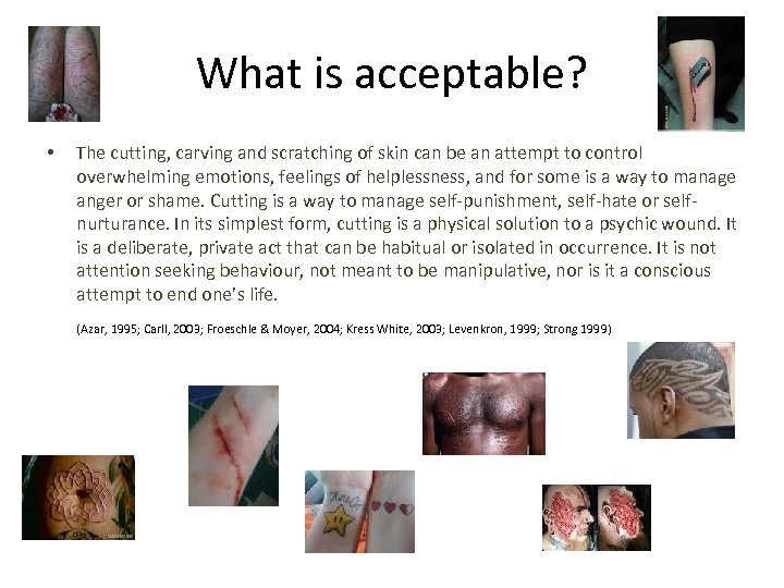 What is acceptable? • The cutting, carving and scratching of skin can be an