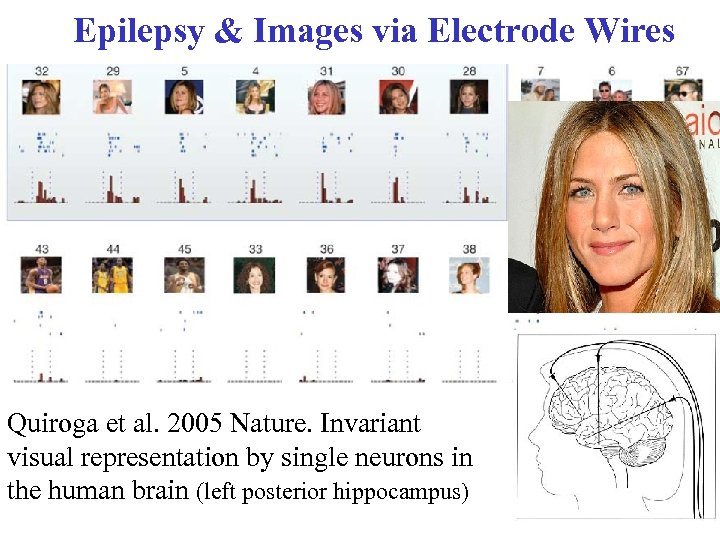 Epilepsy & Images via Electrode Wires Quiroga et al. 2005 Nature. Invariant visual representation