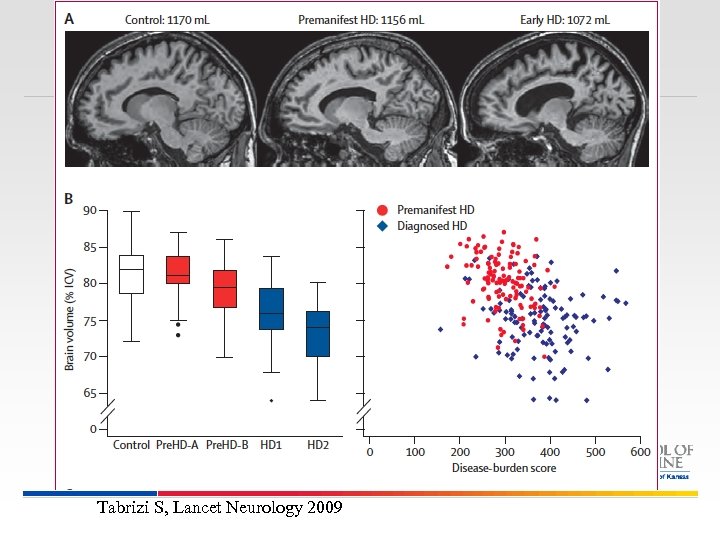 Tabrizi S, Lancet Neurology 2009 