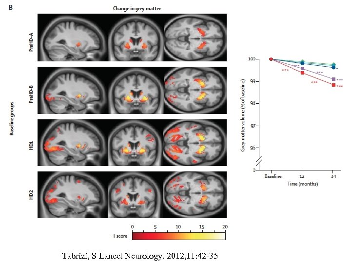 Tabrizi, S Lancet Neurology. 2012, 11: 42 -35 