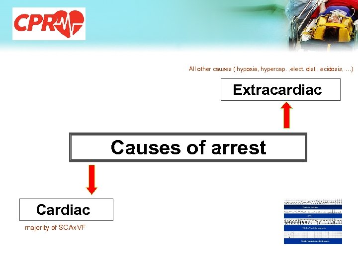 All other causes ( hypoxia, hypercap. , elect. dist. , acidosis, …) Extracardiac Causes