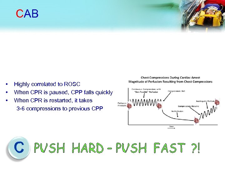 CAB • • • Highly correlated to ROSC When CPR is paused, CPP falls