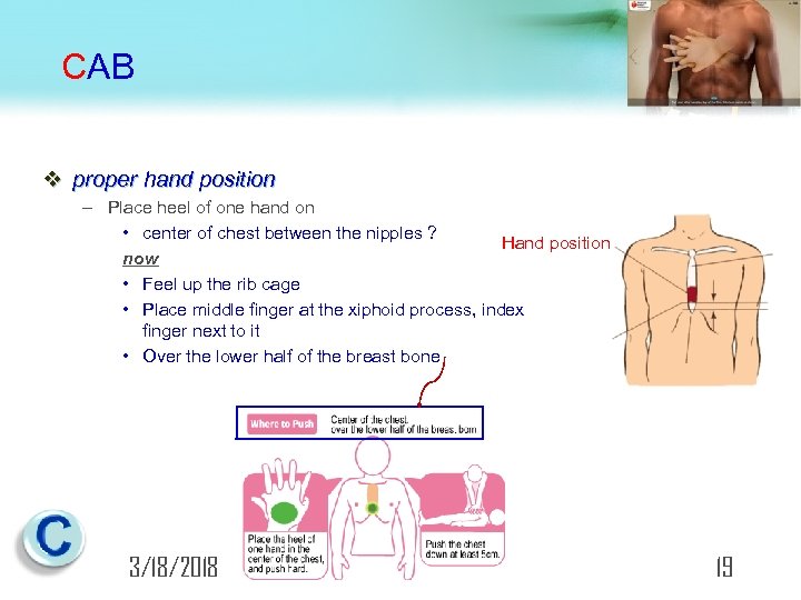CAB v proper hand position – Place heel of one hand on • center