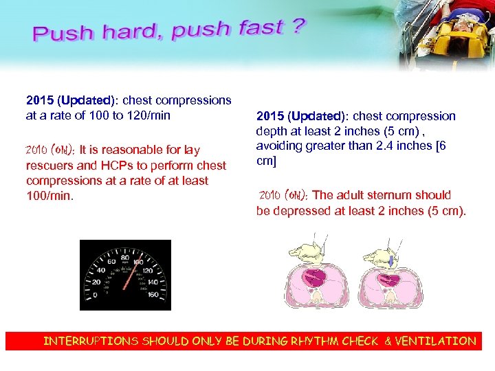 2015 (Updated): chest compressions at a rate of 100 to 120/min 2010 (Old): It