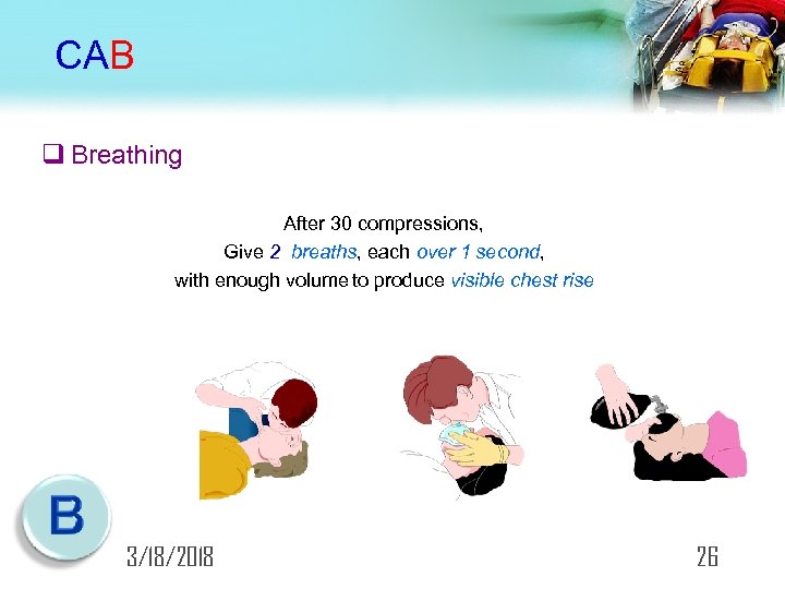 CAB q Breathing After 30 compressions, Give 2 breaths, each over 1 second, with