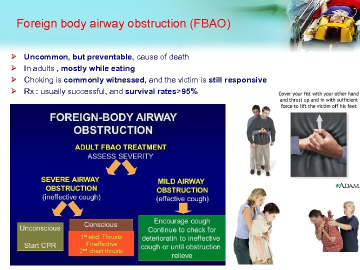 Foreign body airway obstruction (FBAO) Ø Ø Uncommon, but preventable, cause of death In