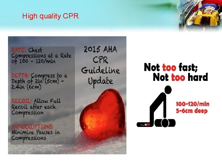 High quality CPR 