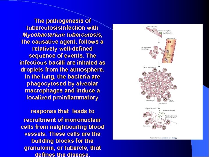 The pathogenesis of tuberculosis. Infection with Mycobacterium tuberculosis, the causative agent, follows a relatively